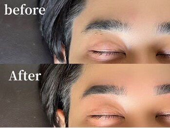 エムズアイブロウ 京都烏丸店(M’sアイブロウ)/メンズWAX脱毛★before→After