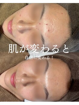 インテリウス(INteRius.)/自己肯定感を上げる！