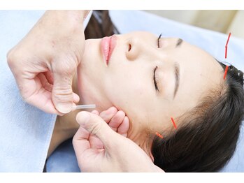 リケア鍼灸整骨院の写真/美容鍼で深層へアプローチ！お肌の悩みを根本からケアし、輝く透明感へ☆