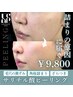 【ニキビケア/脂性肌のケア/毛穴のつまり/黒ずみ】サルチル酸ピーリング
