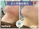 デューン 蕨店(Dune)の写真/通うたび、自分の肌がもっと好きになる。本気の肌質改善サロン