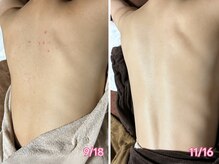ピリナ 名古屋の雰囲気（日本最高峰ハーブピーリングローズドメーラで結果出し◎実績10年）