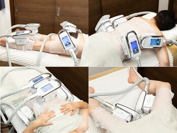 ソフィームの写真/二の腕/ハミ肉に集中ケア◎大人気★脂肪冷却×EMSで脂肪細胞に徹底アプローチ♪[立川/痩身/ダイエット]