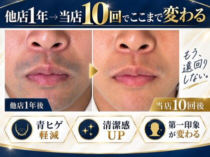 ミスターアンクール 鹿児島(Mr.uncoeur)の写真