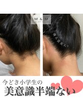 エムアンドエム(M&M)/