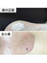 美鼻ラボ 押上 曳舟/よく見るアレ。