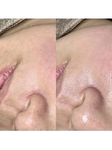 ハイク バイ ジェン(HIKE by gen.)/フェイシャルワックス