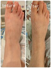 サロンドットブレスドットケイ(salon.bless.k)/むくみ/冷え/重たい／リンパ