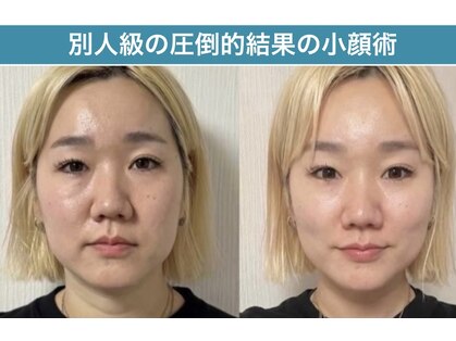 アリィ(Alii hisaya)の写真