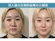 アリィ(Alii hisaya)の写真