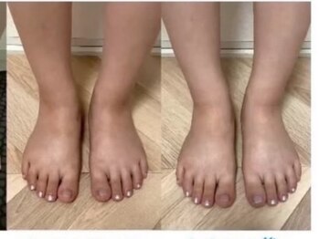 ヨサパーク ベル(YOSA PARK Belle)/浮腫みがしっかりとれる！