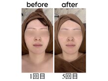 インディバケアプラチナム 横浜店の雰囲気(術後ケアにおススメ★)