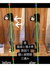 はまもと整骨院/整体・姿勢改善