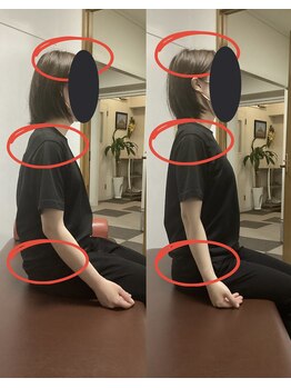 ほぐし名人/姿勢矯正ビフォーアフター☆