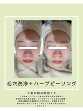 ソワナ(soina)/【神楽坂駅/フェイシャル/毛穴】