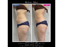 イデアール(ideal)