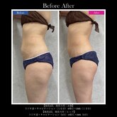 イデアール(ideal)