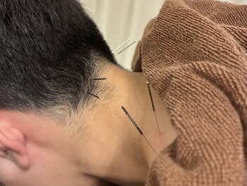 鍼灸 整体院 スズユ(SUZUYU)/【北浜/鍼灸/整体/首こり改善】