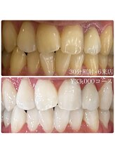 ホワイトニングルーム 横浜店(Whitening Room)/セルフホワイトニング/横浜