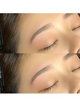 スパーブ(Superb)/平行アーチ