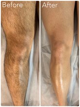 ビオトーン バイ ツリー(biotone by TREE)/男性/Wax脱毛/脚all