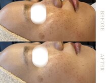 ソワ 恵比寿(soi)/ENVIRONエンビロンフルコース