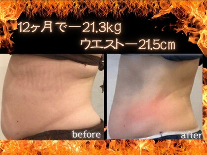 ワイキューマルサン(y903)の写真