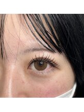 レジアント(Rediant)/