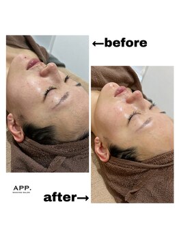 アプ(APP.)/本格シェービングbefore→after