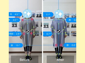 ナオル整体 春日部院(NAORU整体)/腰痛だけじゃない!歪みも改善