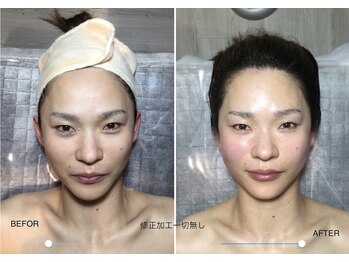 自然美人/小顔コルギの効果