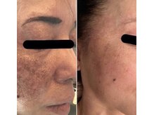 クラティス(CRATIS)/