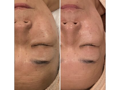 トータルエステティック ジョワイユ(JOYEUX)の写真