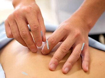 ゆうゆう整体 宇都宮鍼灸院【鍼灸/整体/美容鍼/肩こり/マッサージ/もみほぐし】の写真/重だるい首肩に、深部から効く本格鍼灸ケア★諦めていた痛みに!筋肉の緊張を解き放ち、驚きの軽やかさへ◎