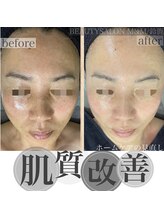 エムアンドエム(M&M)/