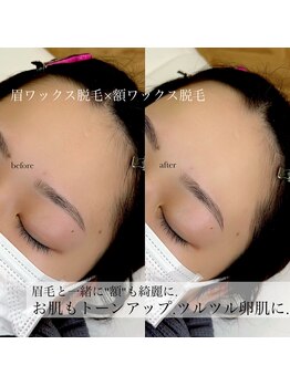 ホワイトアイ 堺東(WHITE EYE)/◇オプションメニューも大人気