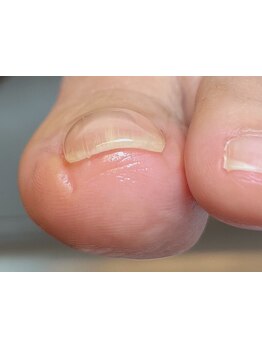 爪の悩みを解消できる（ケア含む）