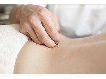 いちろう鍼灸治療院/