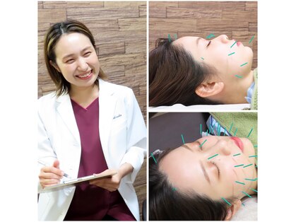 わきさか鍼灸整骨院・鍼灸院 レーヴ(Reve)の写真