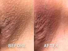 ドアディ(Doordie)/ローマピンク