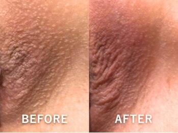 ドアディ(Doordie)/ローマピンク