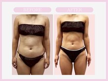 スリムライン 青森店(The Slim Line)/before→after