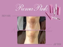 リー(Riy)/《Before and After》