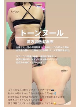 サロン ヴィプラス(SALON Vi+)/トーンヌールの効果
