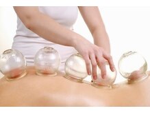 エステティックサロン ヨウコ/カッピング