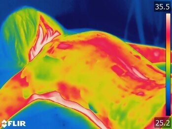 美人バスト 浜松店/マシーン施術後の冷え改善→→→