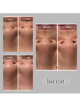 ルーチェット(luceat)/