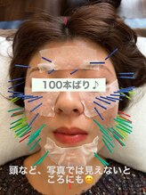 リバイバル(Re:vival)/100本鍼もOK！！