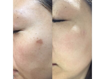 パールプラス 総社店(Pearl plus)の写真