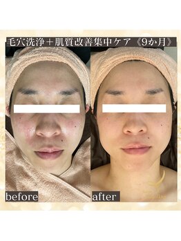 サロン カピリナ(salon Kapilina)/【before→after】